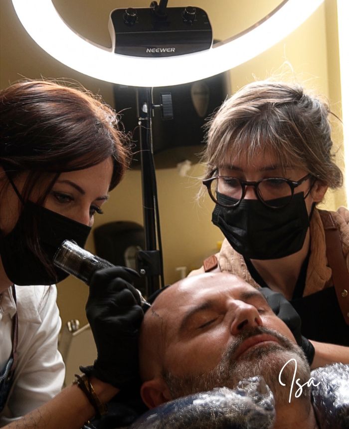 Micropigmentación capilar para alopecia