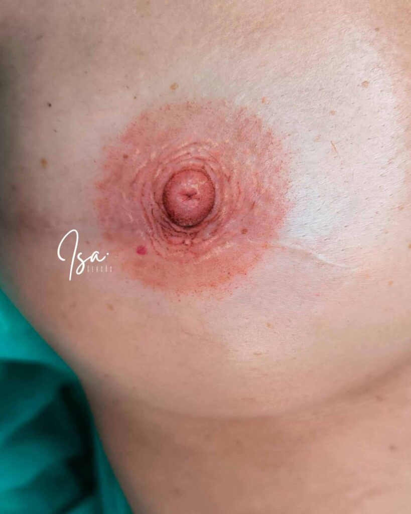 Tatuaje areola post cirugía