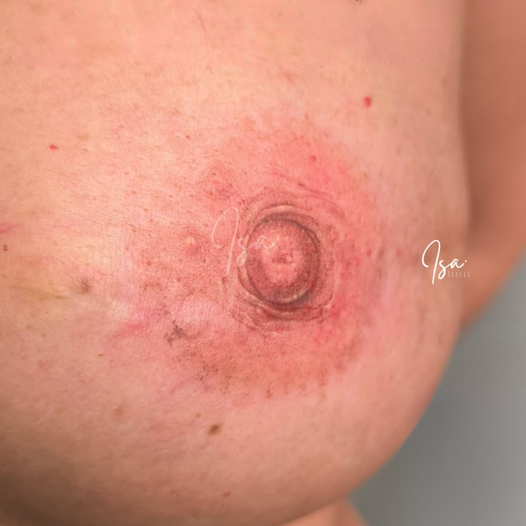 Tatuaje de reconstrucción areola pezón con efecto 3D