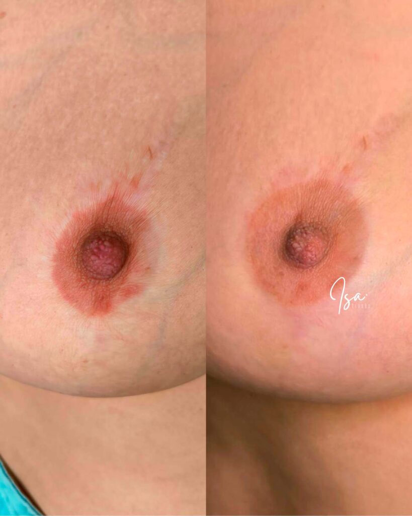 tatuaje de la areola | Isa Cercós