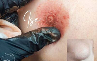 Beneficios del Tatuaje vs la Micropigmentación en Tatuaje mamario